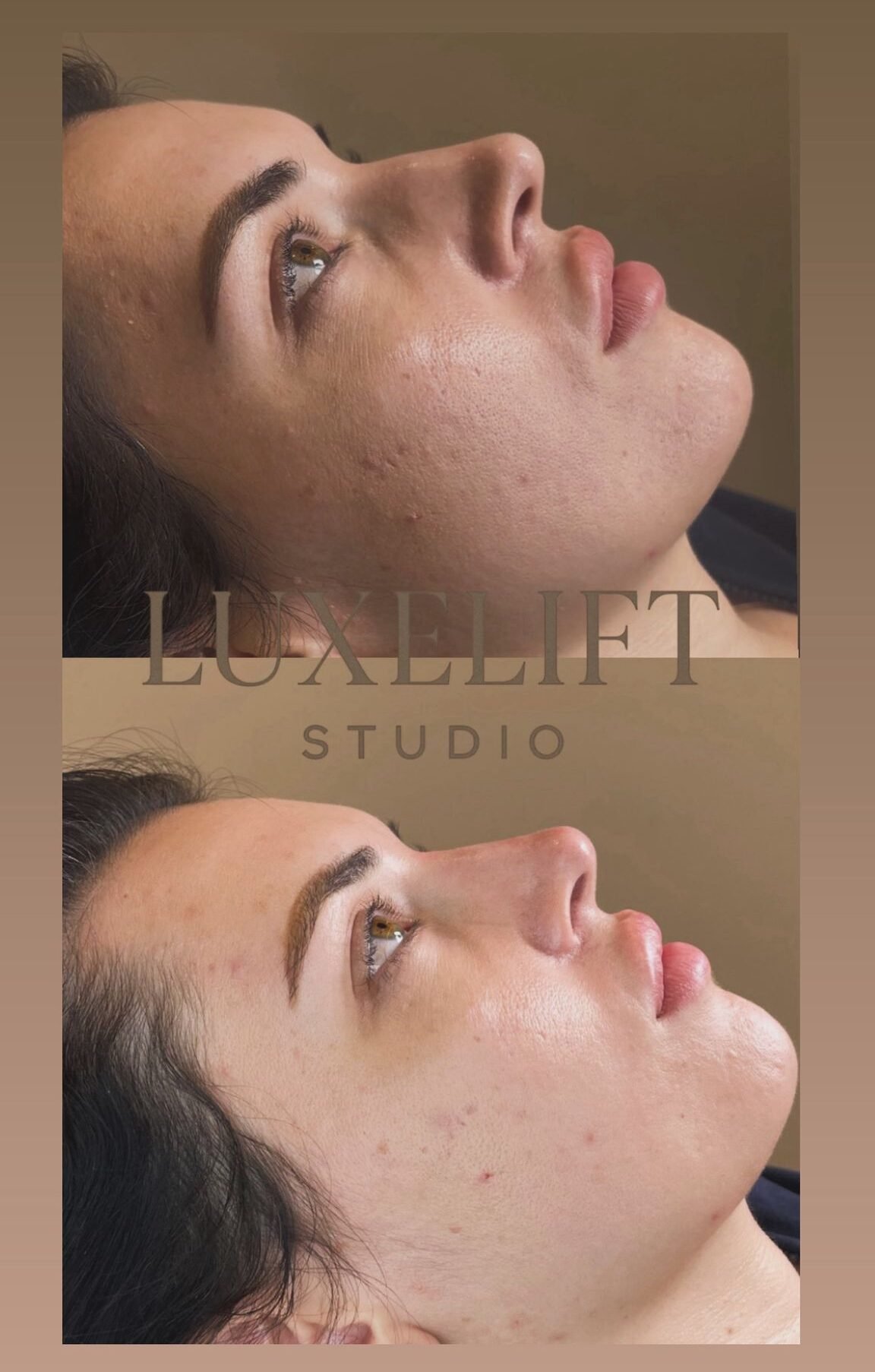 luxelift studios romford