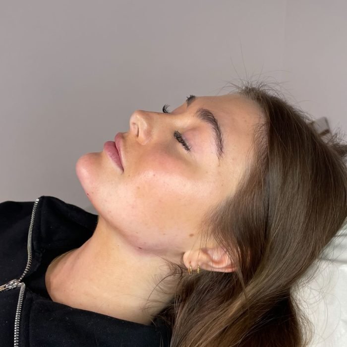 antiwrinkle treatments romford