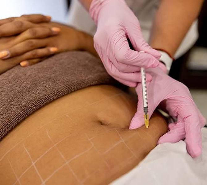 fat dissolving romford