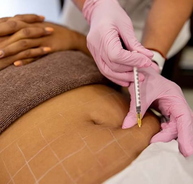 fat dissolving romford